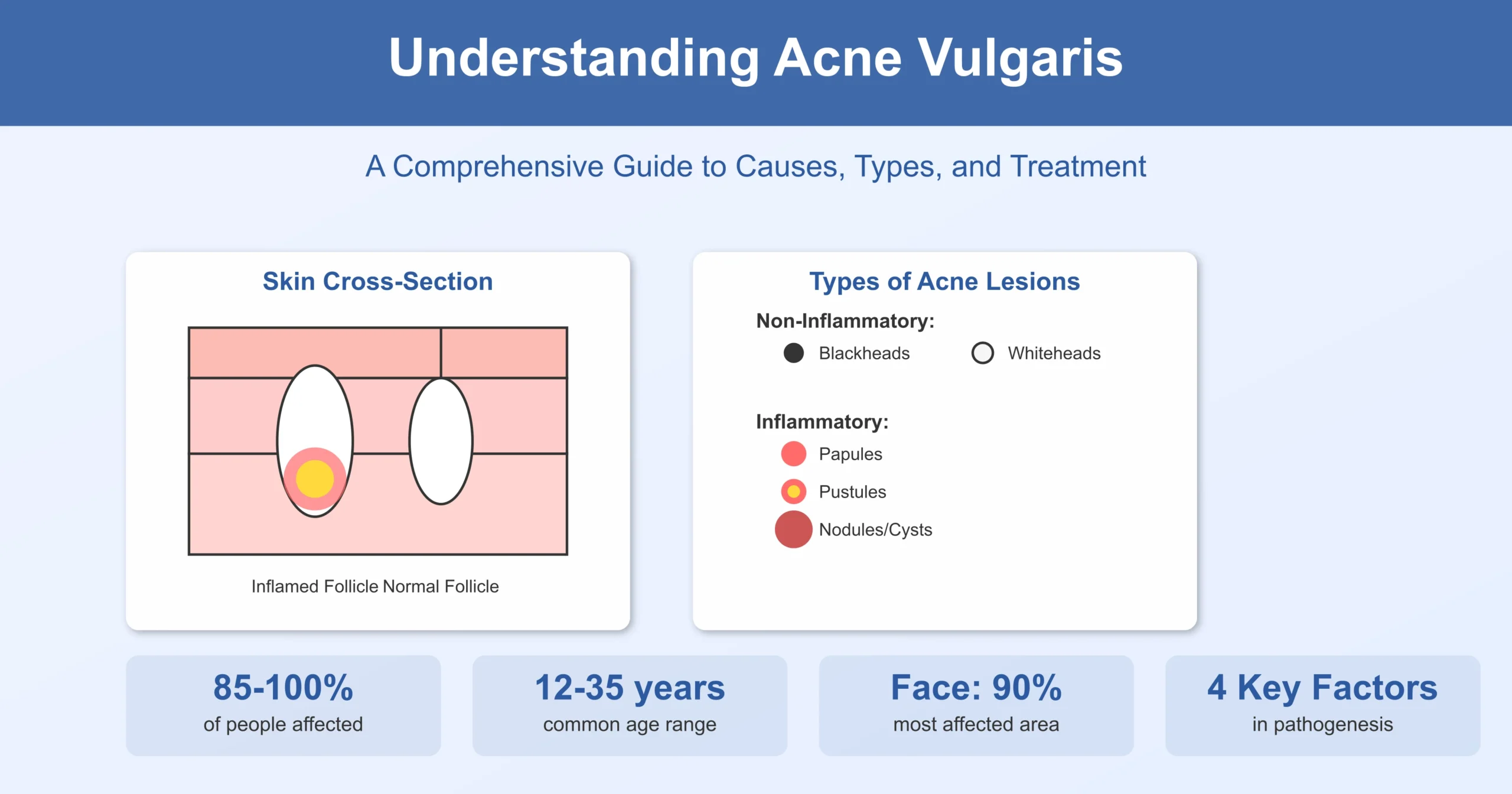 Acne Vulgaris