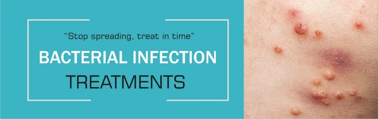 bacterial infections treatment