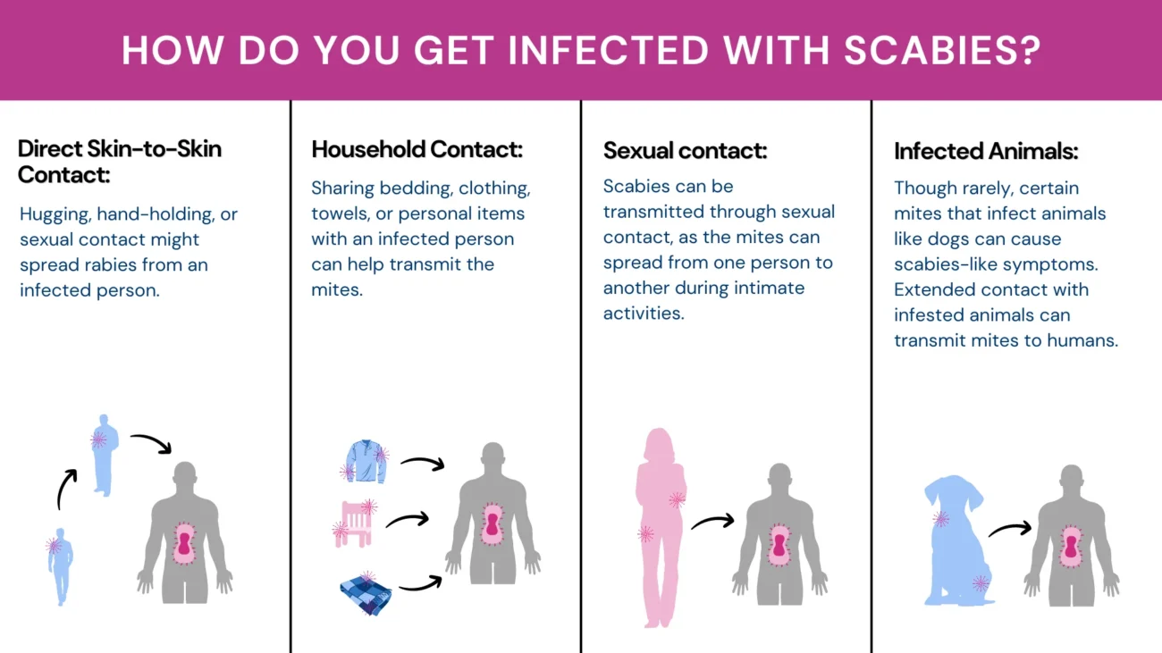 how scabies spread