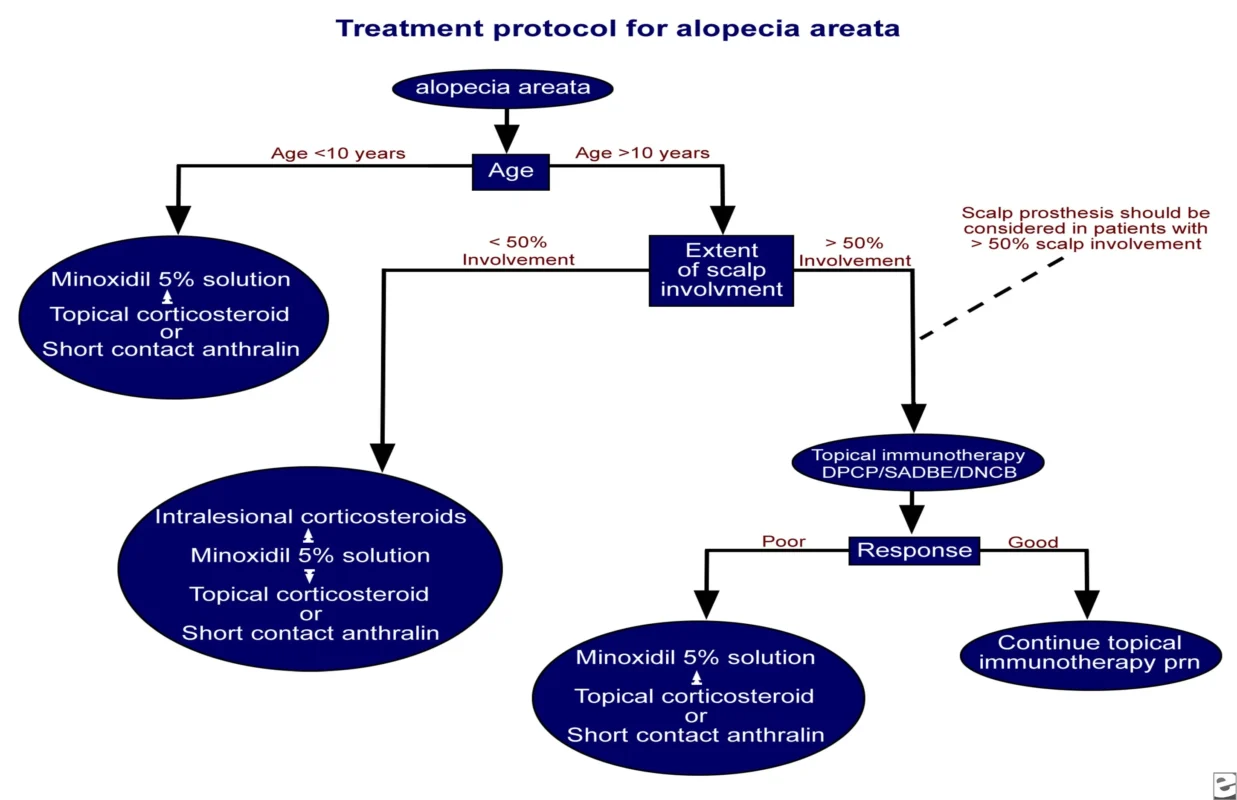management of alopecia