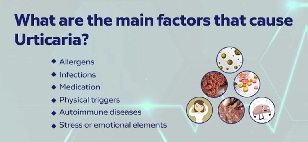 urticaria causes
